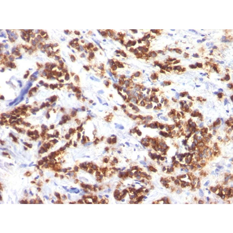 Immunohistochemistry - Anti-Milk Fat Globule Antibody [MFG-06] (A249314) - Antibodies.com