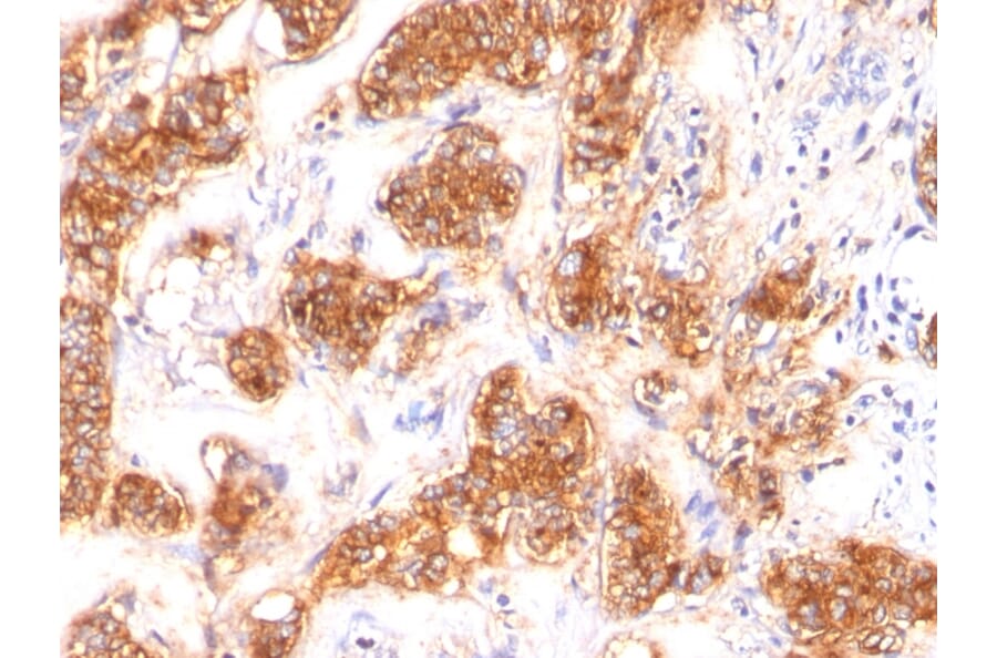 Immunohistochemistry - Anti-Milk Fat Globule Antibody [SPM291] (A249315) - Antibodies.com