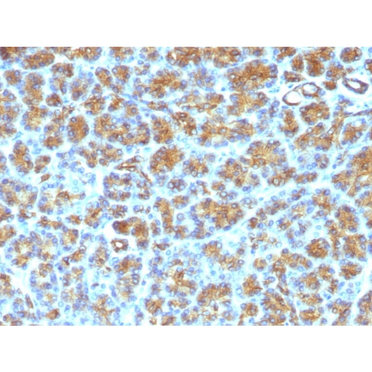 Immunohistochemistry - Anti-Milk Fat Globule Antibody [SPM291] (A249316) - Antibodies.com