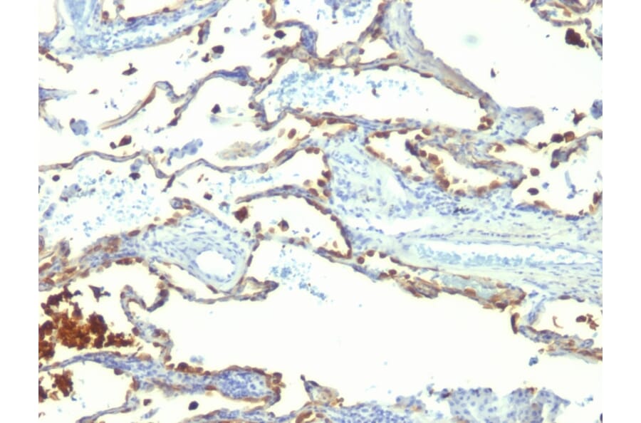 Immunohistochemistry - Anti-Milk Fat Globule Antibody [SPM291] (A249316) - Antibodies.com