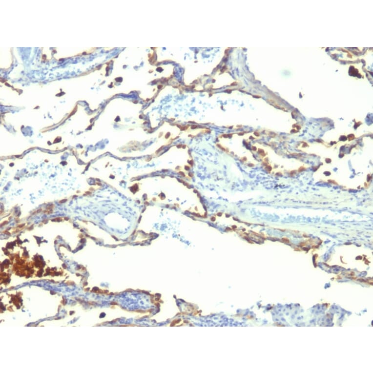 Immunohistochemistry - Anti-Milk Fat Globule Antibody [SPM291] (A249316) - Antibodies.com