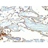 Immunohistochemistry - Anti-Milk Fat Globule Antibody [SPM291] (A249316) - Antibodies.com