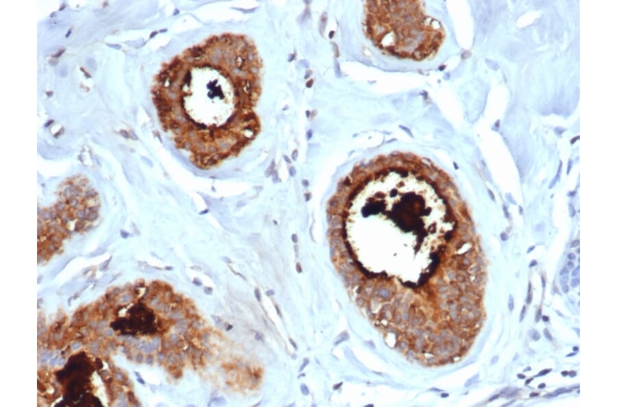 Immunohistochemistry - Anti-Mammaglobin A Antibody [rMGB/6619] (A249317) - Antibodies.com