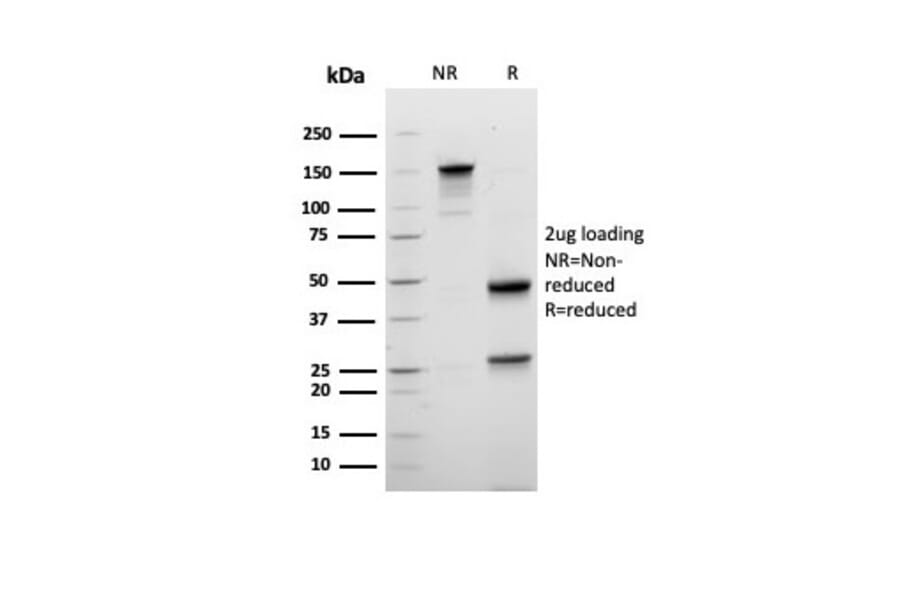 SDS-PAGE - Anti-Mammaglobin A Antibody [rMGB/6619] (A249318) - Antibodies.com