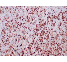 Immunohistochemistry - Anti-Mammaglobin A Antibody [MGB/2000] (A249319) - Antibodies.com