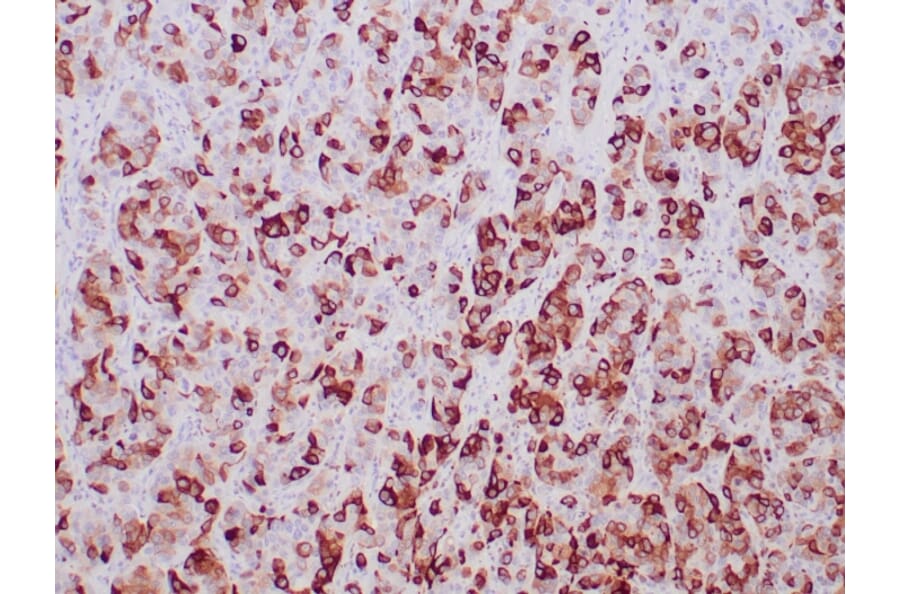 Immunohistochemistry - Anti-Mammaglobin A Antibody [MGB/2000] (A249319) - Antibodies.com