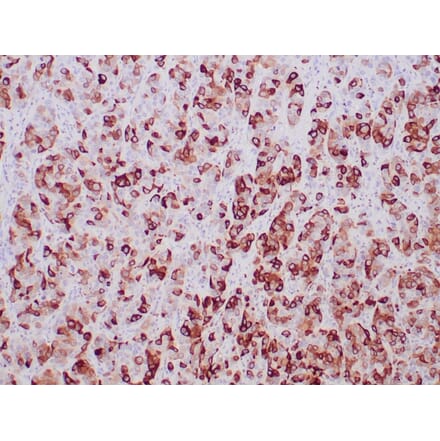 Immunohistochemistry - Anti-Mammaglobin A Antibody [MGB/2000] (A249319) - Antibodies.com