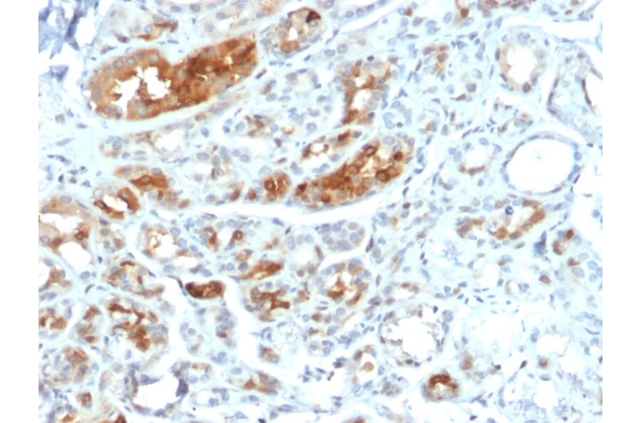 Immunohistochemistry - Anti-Mammaglobin A Antibody [MGB/2000] (A249319) - Antibodies.com