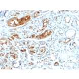 Immunohistochemistry - Anti-Mammaglobin A Antibody [MGB/2000] (A249319) - Antibodies.com