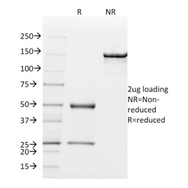 SDS-PAGE - Anti-Mammaglobin A Antibody [MGB/2000] (A249319) - Antibodies.com