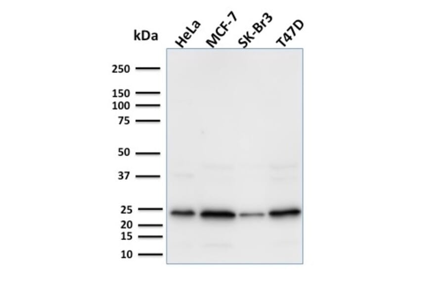 Western Blot - Anti-Mammaglobin A Antibody [MGB/2000] (A249319) - Antibodies.com