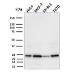 Western Blot - Anti-Mammaglobin A Antibody [MGB/2000] (A249319) - Antibodies.com