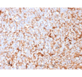 Immunohistochemistry - Anti-Mammaglobin A Antibody [SPM518] (A249320) - Antibodies.com
