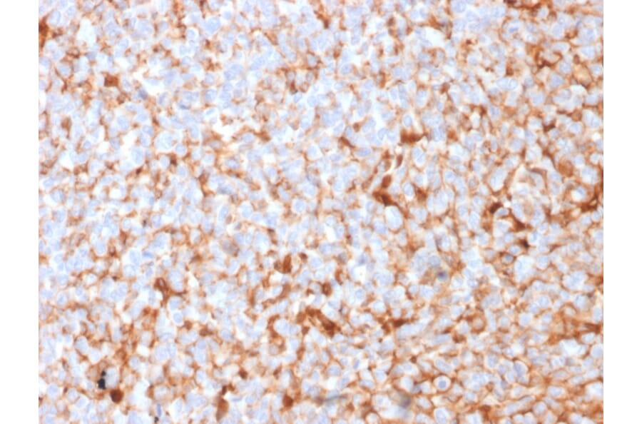 Immunohistochemistry - Anti-Mammaglobin A Antibody [SPM518] (A249320) - Antibodies.com