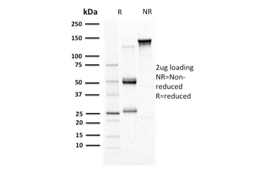 SDS-PAGE - Anti-Mammaglobin A Antibody [SPM518] (A249320) - Antibodies.com