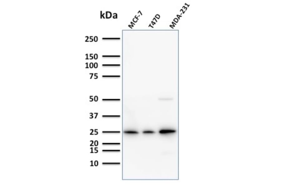 Western Blot - Anti-Mammaglobin A Antibody [SPM518] (A249320) - Antibodies.com