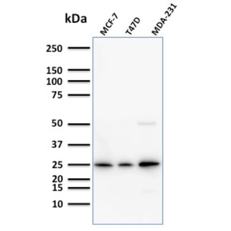 Western Blot - Anti-Mammaglobin A Antibody [SPM518] (A249320) - Antibodies.com
