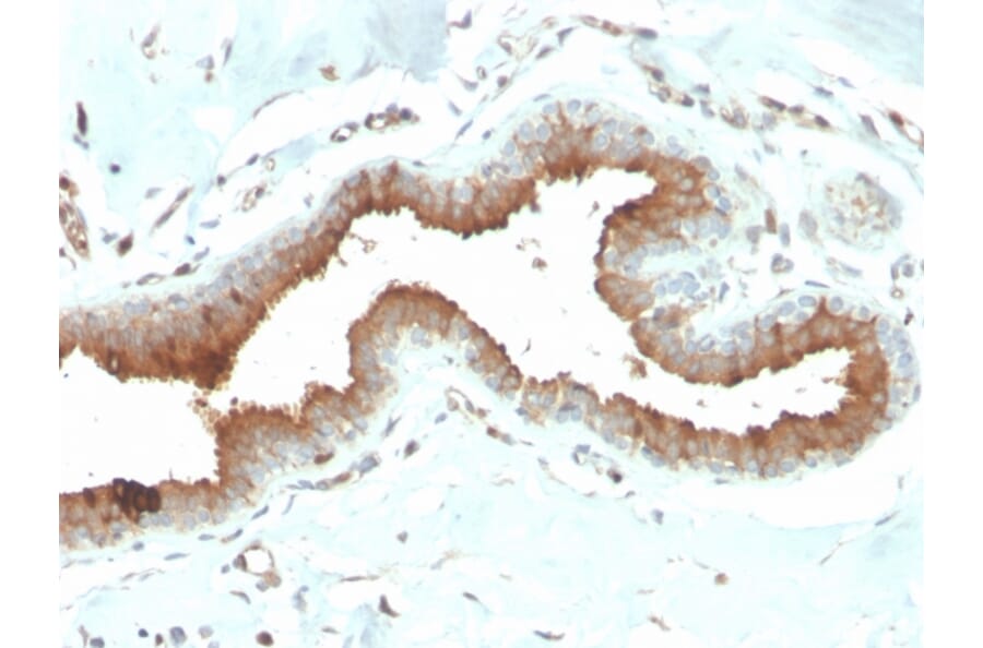 Immunohistochemistry - Anti-Mammaglobin A Antibody [MGB/2704] (A249320) - Antibodies.com