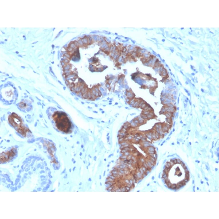 Immunohistochemistry - Anti-Mammaglobin A Antibody [MGB/4056] (A249322) - Antibodies.com