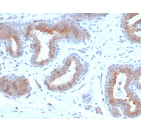 Immunohistochemistry - Anti-Mammaglobin A Antibody [rMGB/4299] (A249323) - Antibodies.com