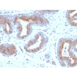 Immunohistochemistry - Anti-Mammaglobin A Antibody [rMGB/4299] (A249323) - Antibodies.com
