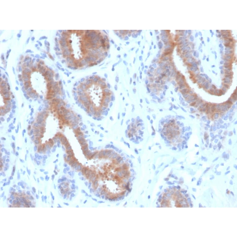 Immunohistochemistry - Anti-Mammaglobin A Antibody [rMGB/4299] (A249322) - Antibodies.com