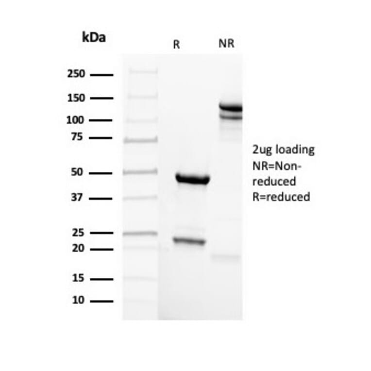 SDS-PAGE - Anti-Mammaglobin A Antibody [rMGB/4299] (A249323) - Antibodies.com