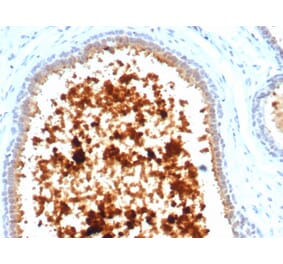 Immunohistochemistry - Anti-Mammaglobin A Antibody [MGB/4811R] (A249324) - Antibodies.com