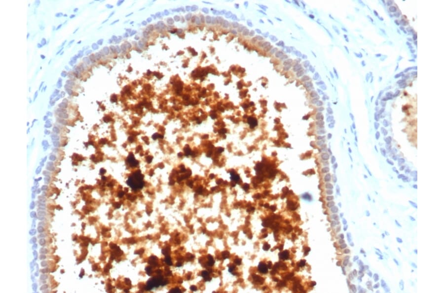 Immunohistochemistry - Anti-Mammaglobin A Antibody [MGB/4811R] (A249324) - Antibodies.com