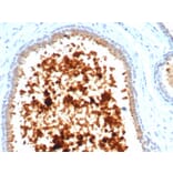 Immunohistochemistry - Anti-Mammaglobin A Antibody [MGB/4811R] (A249324) - Antibodies.com
