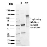 SDS-PAGE - Anti-Mammaglobin A Antibody [MGB/4811R] (A249324) - Antibodies.com