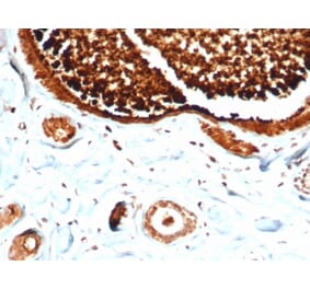 Immunohistochemistry - Anti-Mammaglobin A Antibody [MGB/4812R] (A249325) - Antibodies.com