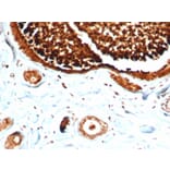Immunohistochemistry - Anti-Mammaglobin A Antibody [MGB/4812R] (A249325) - Antibodies.com