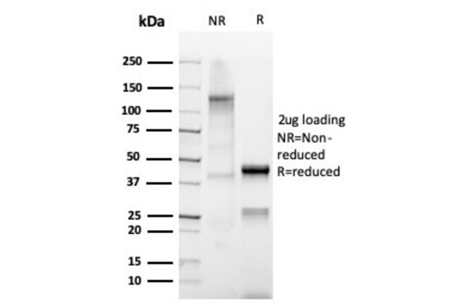 SDS-PAGE - Anti-Mammaglobin A Antibody [MGB/4812R] (A249325) - Antibodies.com