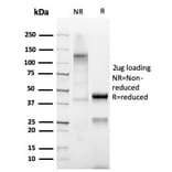 SDS-PAGE - Anti-Mammaglobin A Antibody [MGB/4812R] (A249325) - Antibodies.com