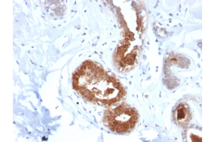 Immunohistochemistry - Anti-Mammaglobin A Antibody [MGB/2123R] (A249326) - Antibodies.com