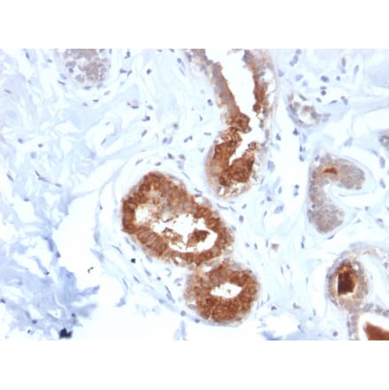 Immunohistochemistry - Anti-Mammaglobin A Antibody [MGB/2123R] (A249326) - Antibodies.com