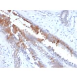 Immunohistochemistry - Anti-Mammaglobin A Antibody [MGB/2123R] (A249325) - Antibodies.com