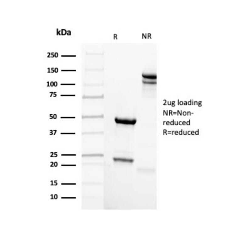 SDS-PAGE - Anti-Mammaglobin A Antibody [MGB/2123R] (A249326) - Antibodies.com
