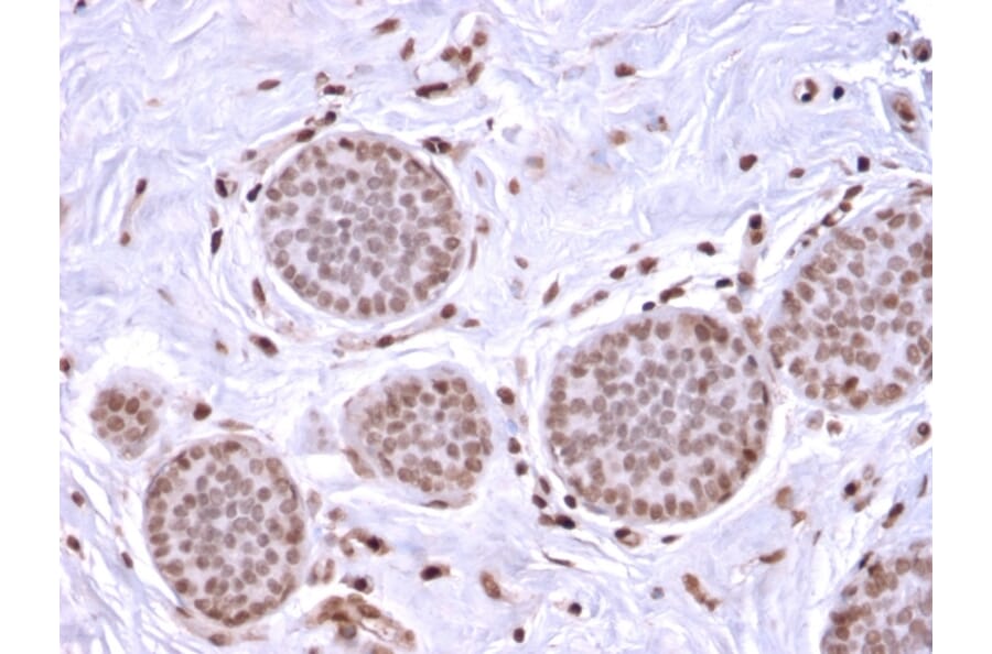 Immunohistochemistry - Anti-Mammaglobin A Antibody [MGB/2682R] (A249327) - Antibodies.com