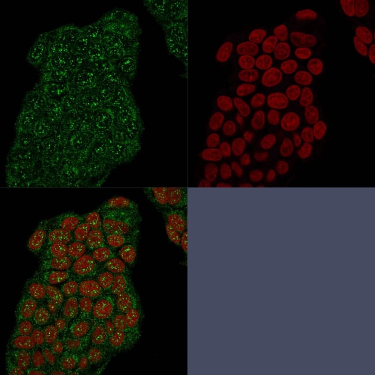 Immunofluorescence - Anti-Mammaglobin A Antibody [MGB/2682R] (A249326) - Antibodies.com