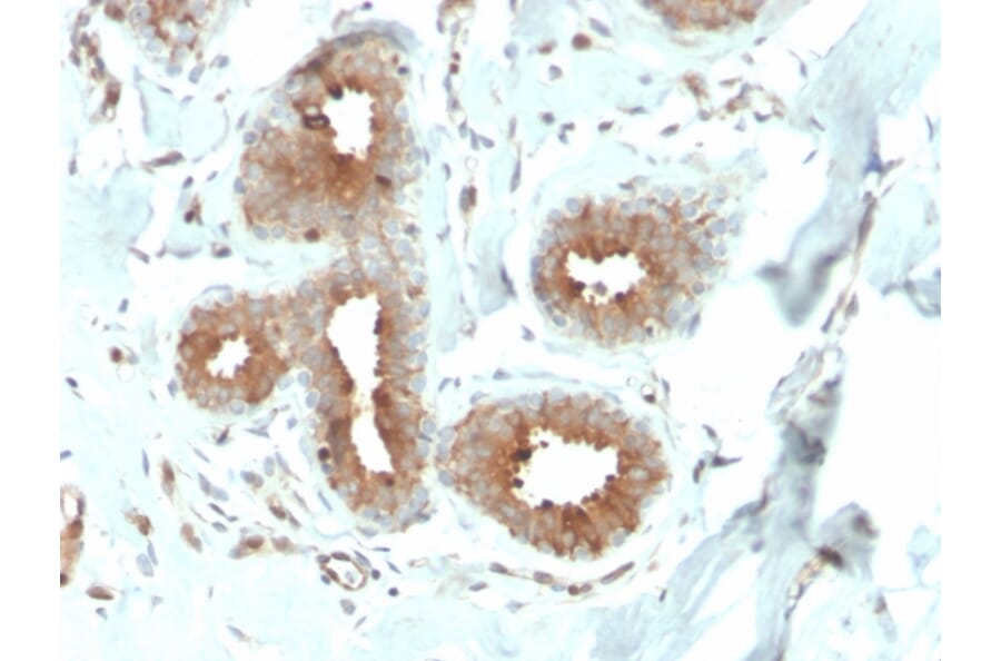 Immunohistochemistry - Anti-Mammaglobin A Antibody [MGB/4057R] (A249328) - Antibodies.com