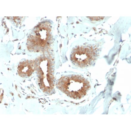 Immunohistochemistry - Anti-Mammaglobin A Antibody [MGB/4057R] (A249328) - Antibodies.com