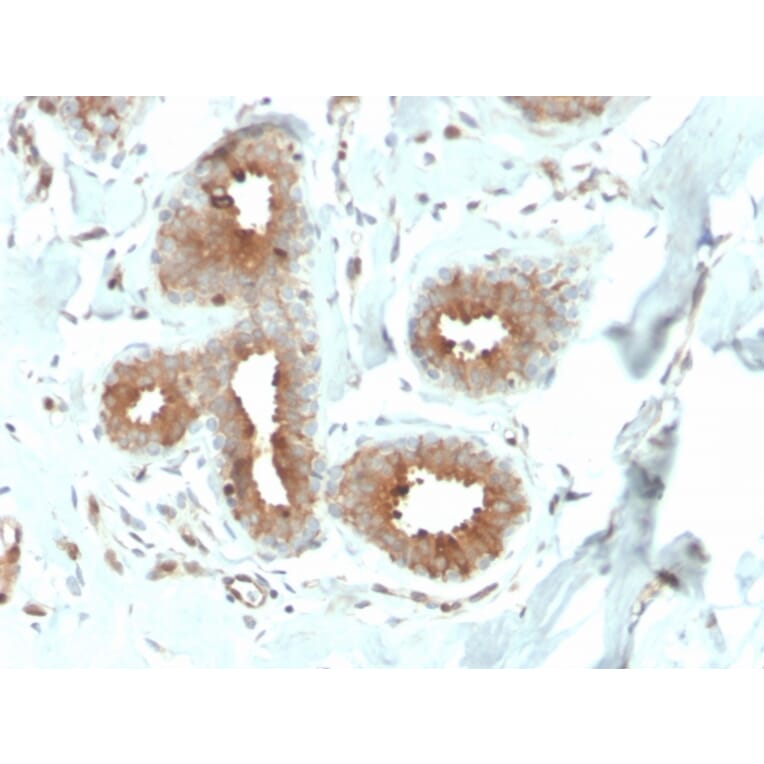Immunohistochemistry - Anti-Mammaglobin A Antibody [MGB/4057R] (A249328) - Antibodies.com