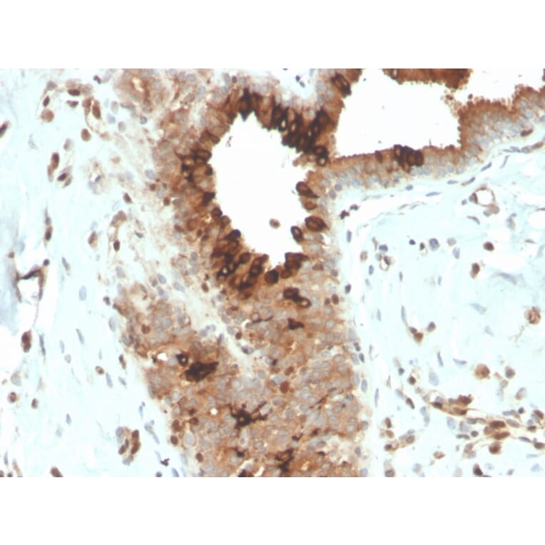 Immunohistochemistry - Anti-Mammaglobin A Antibody [MGB/4057R] (A249328) - Antibodies.com