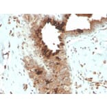 Immunohistochemistry - Anti-Mammaglobin A Antibody [MGB/4057R] (A249328) - Antibodies.com