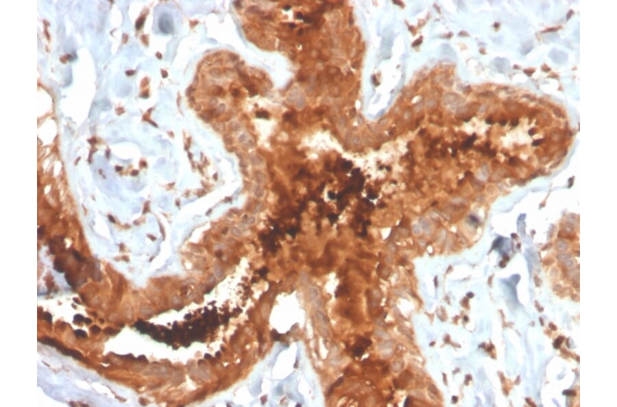 Immunohistochemistry - Anti-Mammaglobin A Antibody [MGB/4058R] (A249329) - Antibodies.com