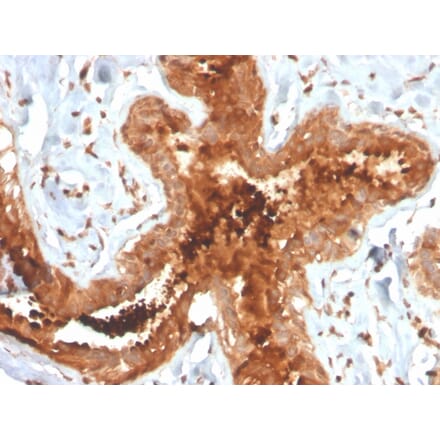 Immunohistochemistry - Anti-Mammaglobin A Antibody [MGB/4058R] (A249329) - Antibodies.com