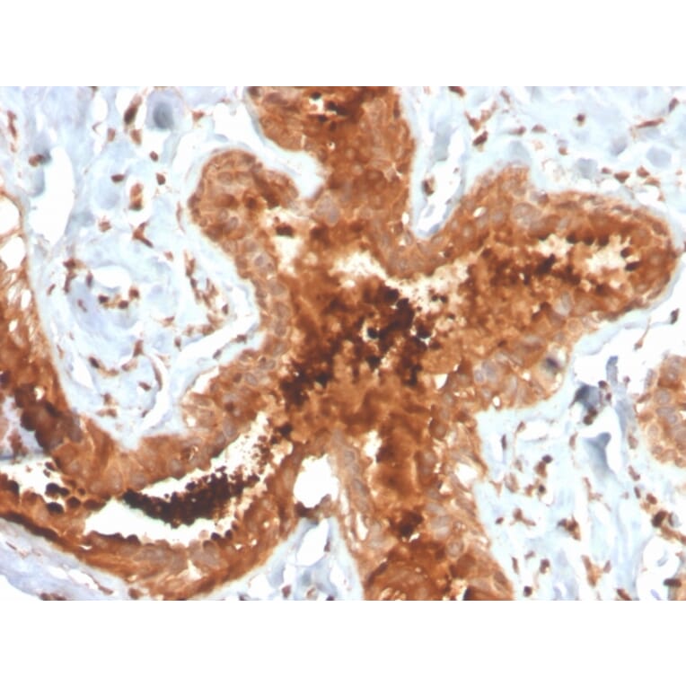 Immunohistochemistry - Anti-Mammaglobin A Antibody [MGB/4058R] (A249329) - Antibodies.com