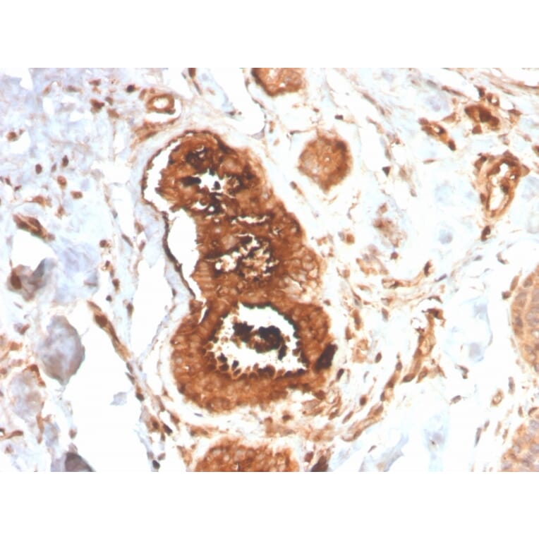 Immunohistochemistry - Anti-Mammaglobin A Antibody [MGB/4058R] (A249328) - Antibodies.com